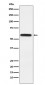 Lgi1 Antibody