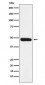 ERCC8 Antibody