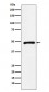 CTBP2 Antibody