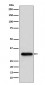NUDT5 Antibody