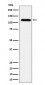 UBE4A Antibody
