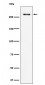 CHD3 Antibody