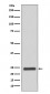 MRRF Antibody