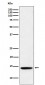 Histone H2B (formyl K120) Antibody