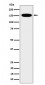 CNAP1 Antibody