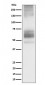 Somatostatin Receptor 1 Antibody