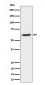 IKZF3 Antibody