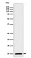 S100 alpha Antibody