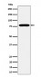 GFPT1 Antibody