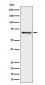 GRK6 Antibody