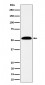 ALDH7A1 Antibody