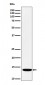 FDX1 / ADX Antibody
