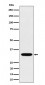 TSFM Antibody