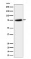 PPM1G Antibody