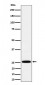 TEMT Antibody
