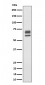 PPP2R5D Antibody