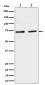 SLC25A12 Antibody