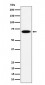 SLC27A4 Antibody