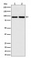 CSDE1 Antibody