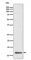TCTEX1 Antibody
