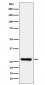 DcR1 / CD263 Antibody