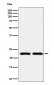 RAB22A Antibody