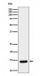 Histone H2B (crotonyl K12) Antibody