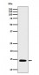 Histone H2B (acetyl K16) Antibody