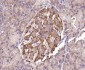 Hrasls3 Rabbit pAb