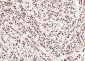 ERCC1 Recombinant Rabbit mAb