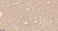 APPL1 Recombinant Rabbit mAb