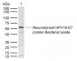 HPV16 E7 Rabbit pAb