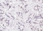 ERCC1 Recombinant Rabbit mAb