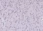 AEBP1 Rabbit pAb