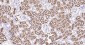 LRP2 Recombinant Rabbit mAb