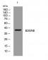 B3GN8 Rabbit Polyclonal Antibody
