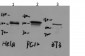 ERK5 (6D10) Mouse Monoclonal Antibody