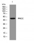PRCC Rabbit Polyclonal Antibody