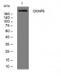 CKAP5 Rabbit Polyclonal Antibody