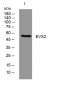 EVX2 Rabbit Polyclonal Antibody