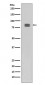 Phospho-HSF1 (S326) (11W18) Rabbit Monoclonal Antibody