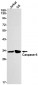 Caspase-6 (16F8) Rabbit Monoclonal Antibody
