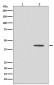Phospho-MEK1 (T292) (13X15) Rabbit Monoclonal Antibody
