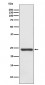 HSPB8/HSP22 (14N5) Rabbit Monoclonal Antibody