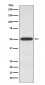 Endothelin B Receptor (17V12) Rabbit Monoclonal Antibody