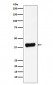 Galectin 8 (14S17) Rabbit Monoclonal Antibody