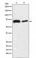 SLC27A4 / FATP4 (15B5) Rabbit Monoclonal Antibody