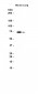 ALOX15 (19A1) Rabbit Monoclonal Antibody