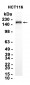 DEPDC5 (3L15) Rabbit Monoclonal Antibody