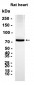 Phospho-PKC alpha (Thr497) (1U14) Rabbit Monoclonal Antibody